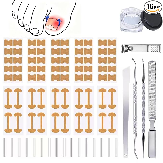 Ingrown Toenail Corrector Set by Unknown