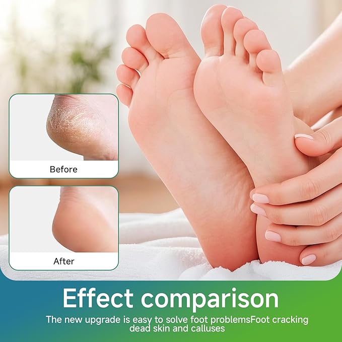 Nano Glass Foot File Callus Remover, Beyond The Cream Foot File, NanoGlass Feet - Image 2