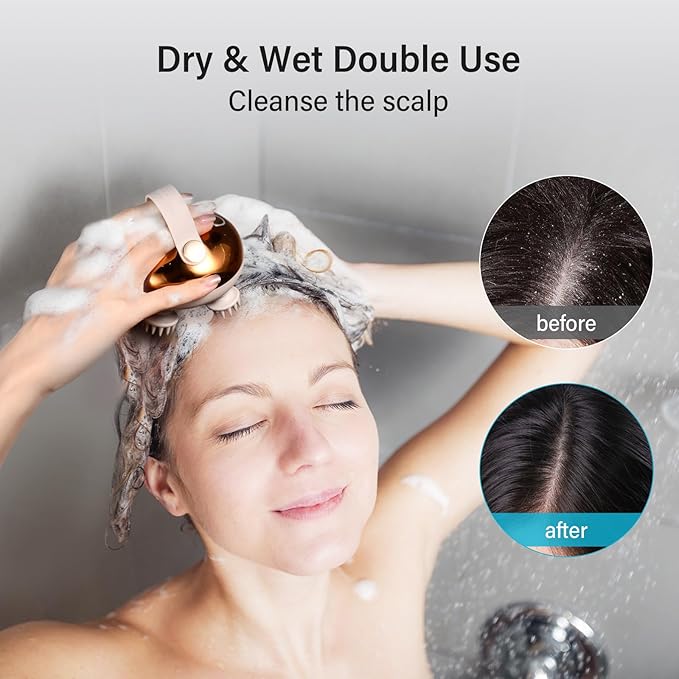 arboleaf Electric Scalp Massager Head Massager Scalp Stress Relax, 5 in 1 - Image 4