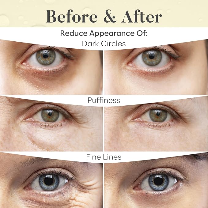 AURAE 24K Gold Under Eye Patches - Image 4