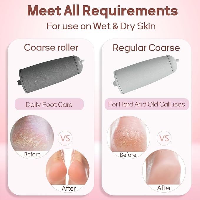 ZABOUL Electric Foot Callus Remover Rechargeable Portable Electric Foot File - Image 4