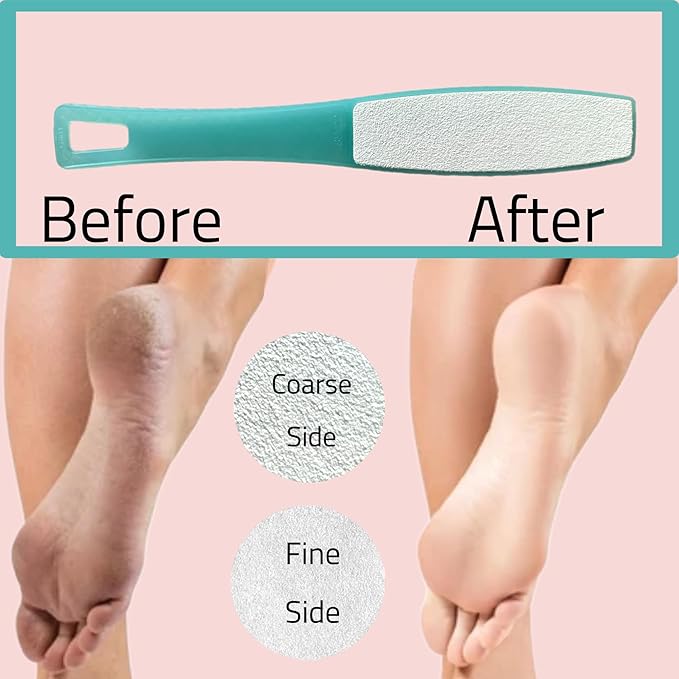 3 ALAZCO Double Sided Foot File Pumice Ergonomic Handle Scrubber Immediate - Image 3