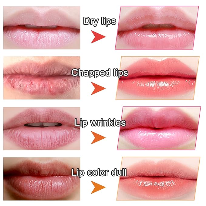 Adofect 30 Pieces Collagen Crystal Lip Masks, Collagen Lip Pads Great - Image 4