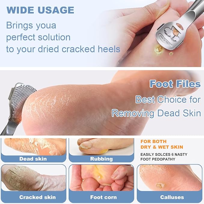 36 Pcs Callus Shaver for Feet Set, Professional Callus Remover for Feet Tools - Image 4