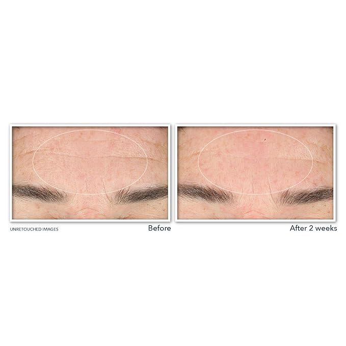 RoC Retinol Correxion Deep Wrinkle Serum Facial Cleanser - Image 3