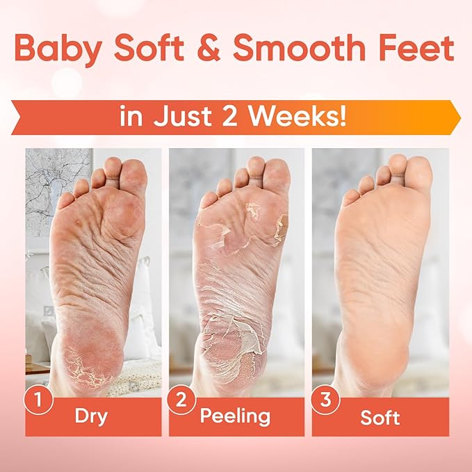 CÉLOR Foot Peeling Mask for Dry Cracked Feet | Foot Mask to Exfoliate Rough - Image 2