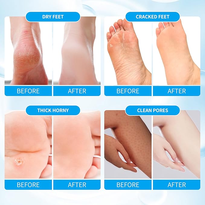 Pedicure Kit Foot Soak Set: Bubble Salt, Sugar Scrub, Massage Mask, Massage - Image 2