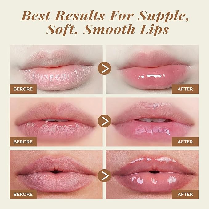 ANAI RUI Coconut Lip Scrub & Lip Mask Set - Image 4