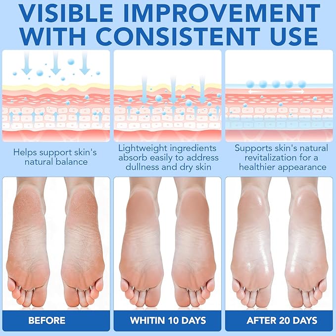 Urea Cream, Maximum Strength Urea Foot Cream, 60% Urea Cream Stick plus 2% - Image 5