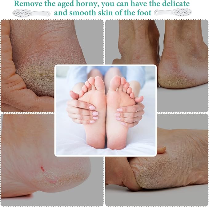 2 Pcs Stainless Steel Foot File Callus Remover Double Sided Metal Foot Rasp - Image 7
