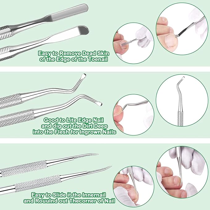 6-Pack Ingrown Toenail File and Lifters, Professional Surgical Stainless Steel - Image 4