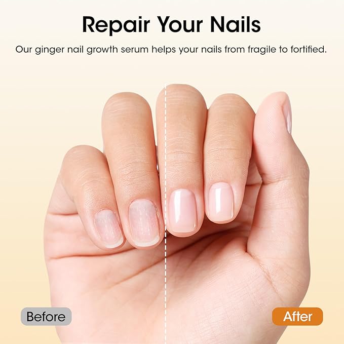 Gellen 30ml Ginger Nail Growth Serum - Image 7