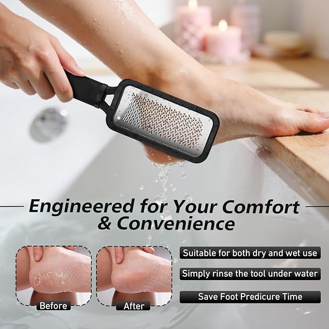 BALUCA Professional Foot File & Callus Remover - Image 6