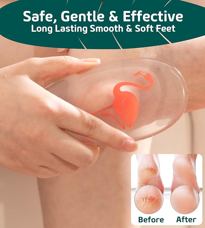 Glass Foot File Callus Remover for Feet, Flamingo Gifts for Women, Feet - Image 3