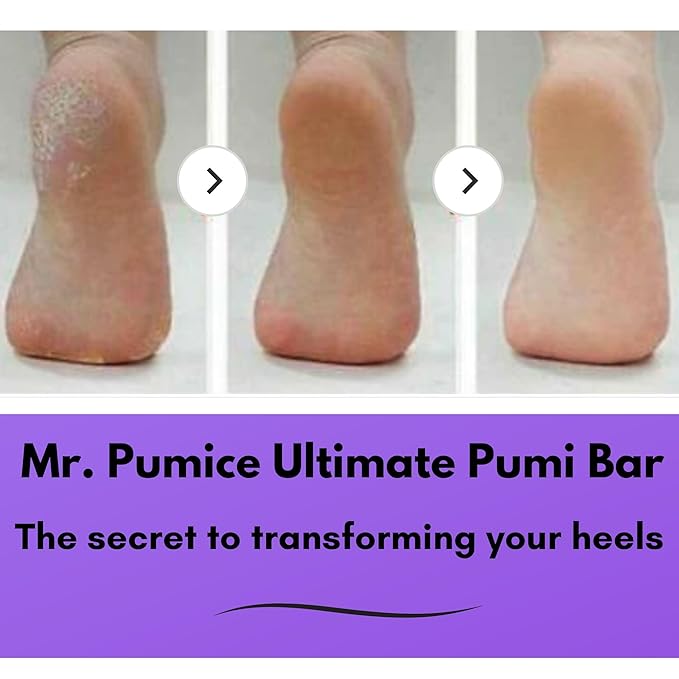 Mr. Pumice Ultimate PUMI Bar 2-in-1 Dual Grit Callus Remover, Pedicure Stone & - Image 3
