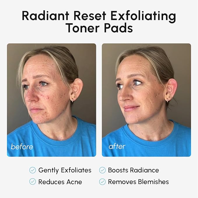 MAREE Glycolic Acid Pads – Toner Pads - Image 4