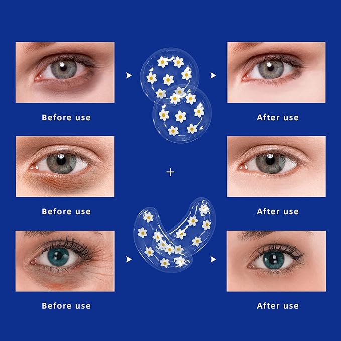 ZNÖCUETÖD Gel Ice Pack Reusable Cooling Eye Pads and Under Eye Patches - Image 6