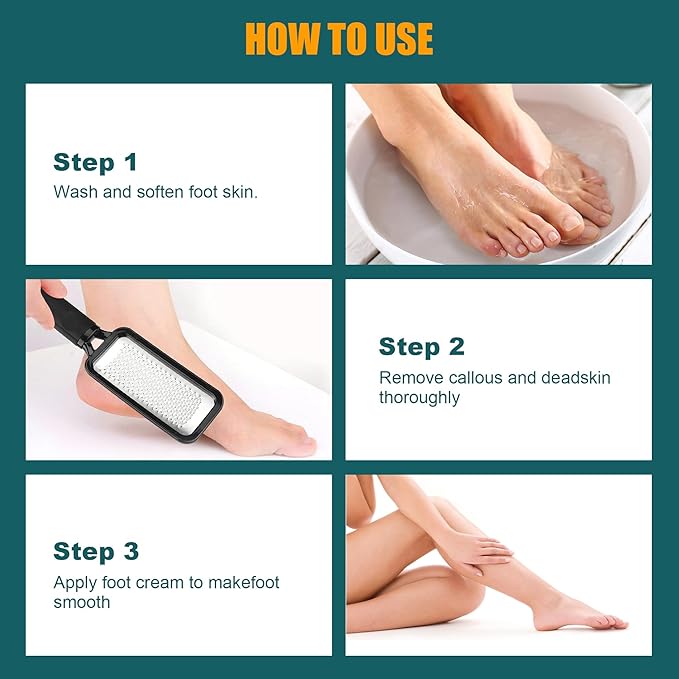 Foot File Foot Scrubber Pedicure, Professional Foot Grater Rasp Scraper Corns - Image 4