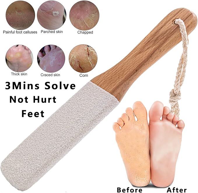 Kinepi Callus Remover Foot Scrubber Colossal Foot File Foot Care and Foot - Image 3