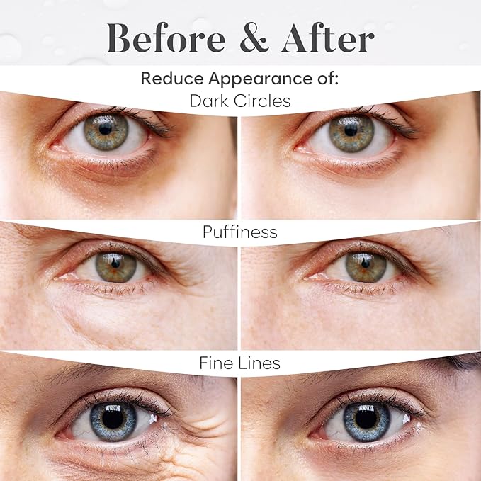 BLOOMORA Variety Box Under Eye Patches - Image 4