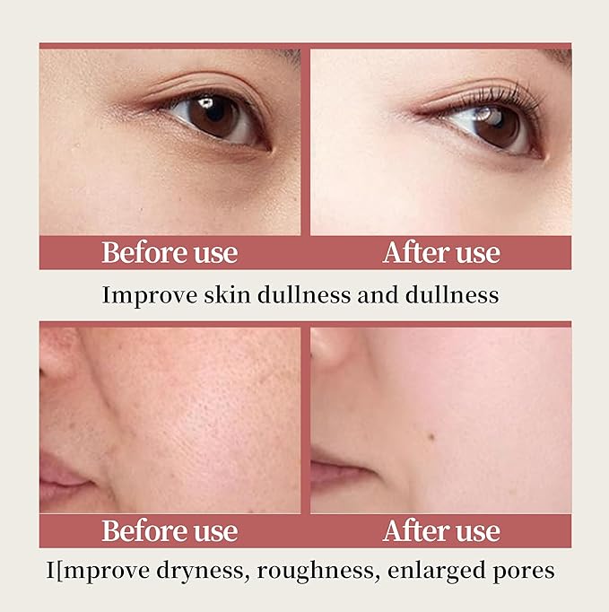 6-Piece Hydrating Skincare Set - Image 7