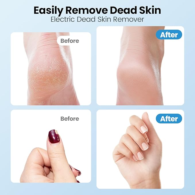 Electric Callus Remover for Feet, 2 in 1 Electric Foot File Grinder, - Image 6