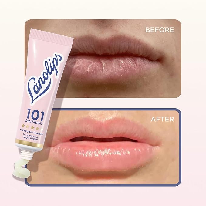 Lanolin 101 Multipurpose Ointment - Image 6