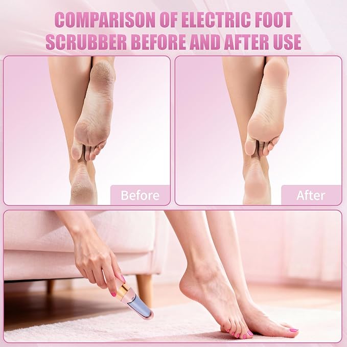 Pedicure Tool, Foot Callus Remover, Electric Pedicure Set, Foot Care, Removes - Image 5