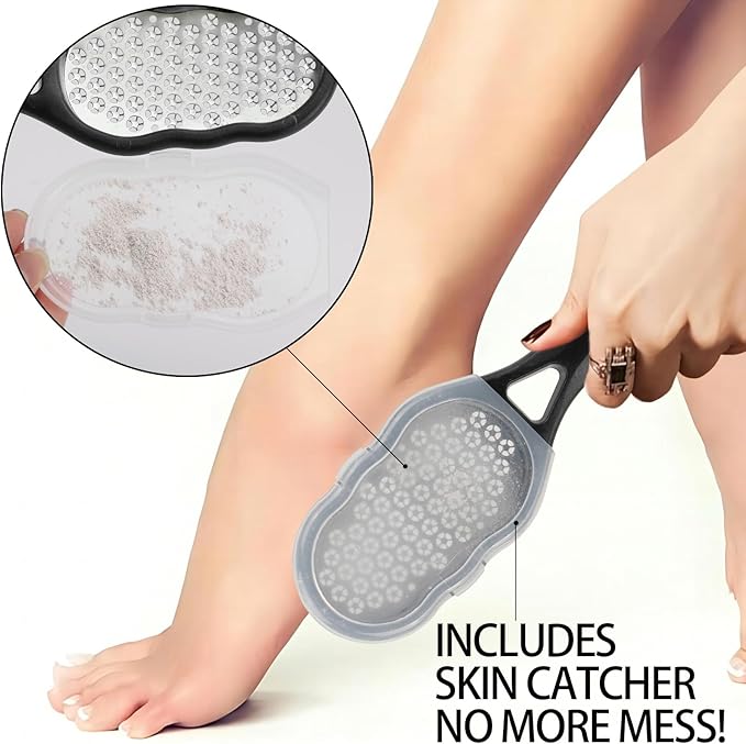 2 Pcs Foot Files with Skin Catcher, Stainless Steel Foot Rasp Callus Remover - Image 4