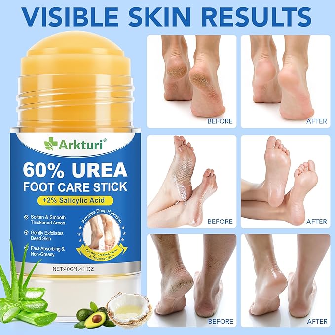 ABOUME 60% Urea Foot Care Stick - Image 3