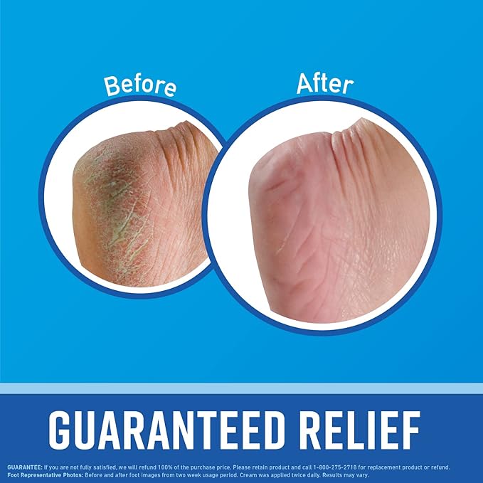 O'Keeffe's Working Hands Hand Cream and Healthy Feet Foot Cream - Image 6