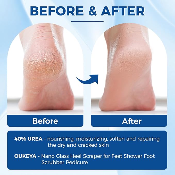 OUKEYA Urea Cream 40 Percent Tube, Urea Cream 40 Percent - Image 4
