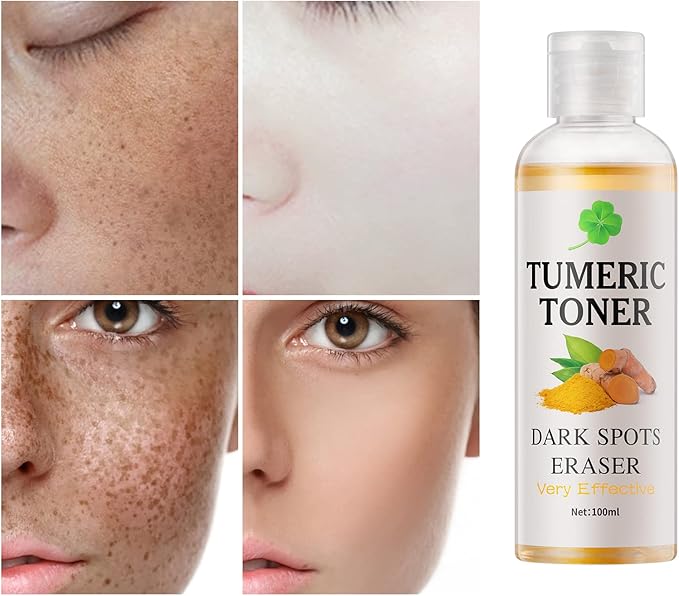 Toner for Dark Spots Turmeric Dark Spot Corrector, Facial Toner for Acne Prone - Image 3