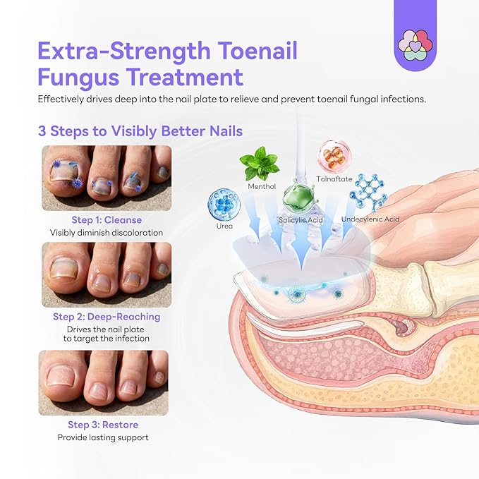 SAVILAND Toenail Fungus Treatment Extra Strength: 2X Extreme Nail Repair - Image 4