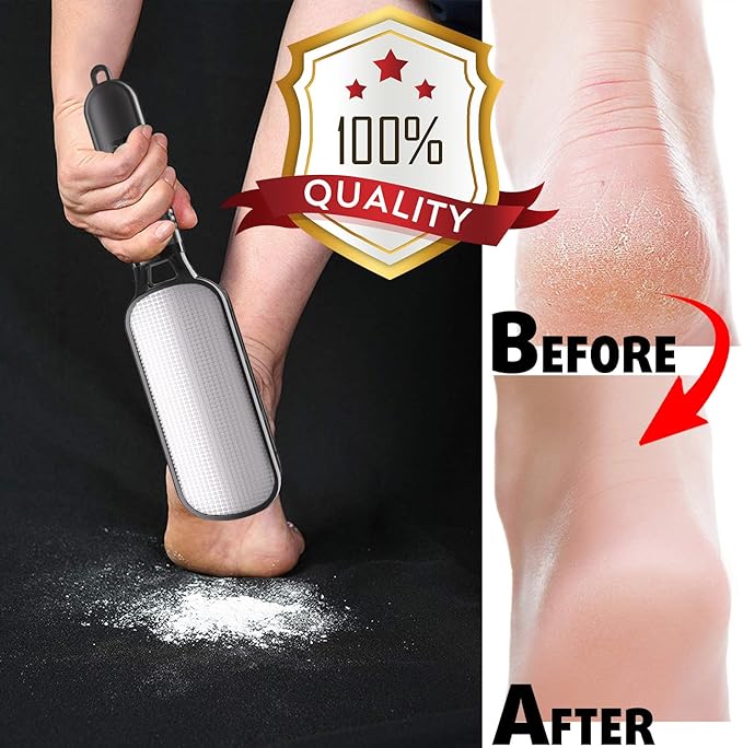 Antonki Foot File for Dead Skin, Double Sided Callus Remover for Feet, Metal - Image 4