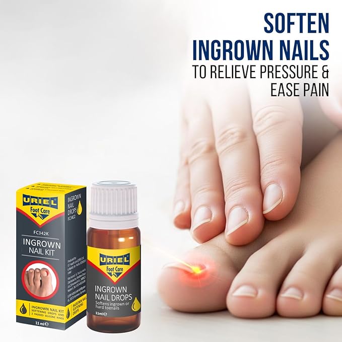 URIEL UPGRADED Ingrown Toenail Treatment - Image 3
