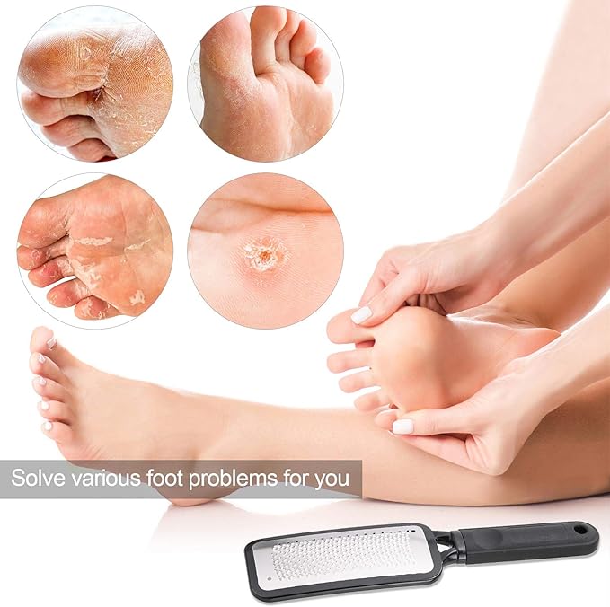 Foot Scrubber Foot Files Callus Remover Black Heel Grater Dead Skin Remover - Image 4