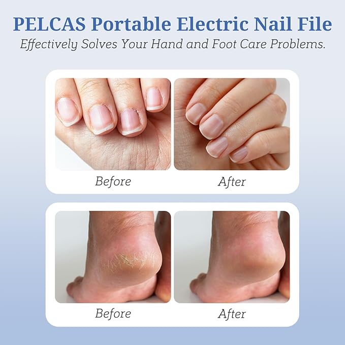PELCAS Electric Nail File, 5 Speeds Manicure and Pedicure Kit, Cordless Nail - Image 2