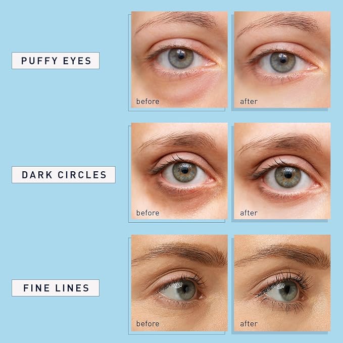 Enaskin Naturals Under Eye Patches - Image 4