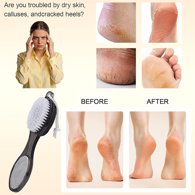 Foot Brush and Pumice Stone for Feet, 4-in-1 Foot File Callus Remover, Feet - Image 3