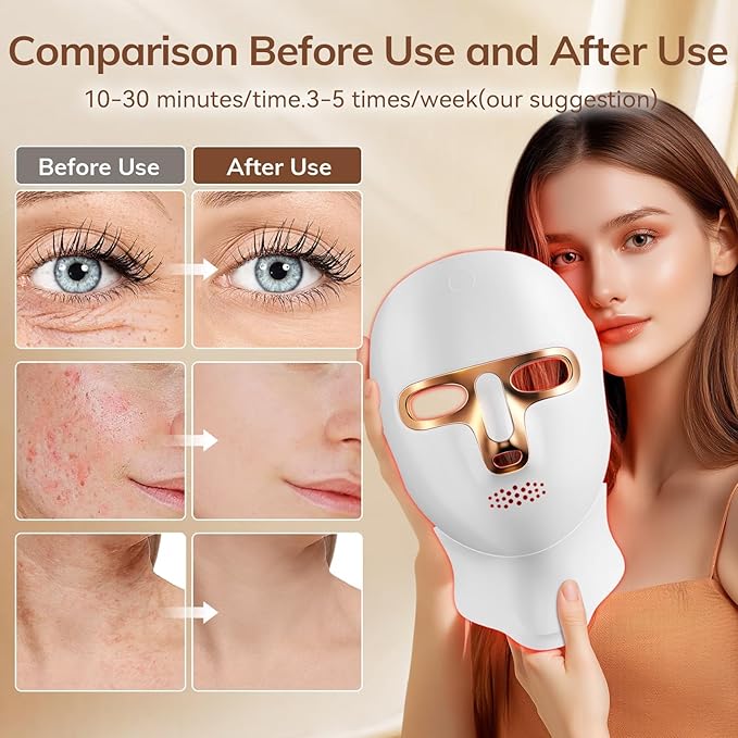 Red Light Therapy Mask for Face, Cordless LED Face Mask Light Therapy, USB C - Image 3