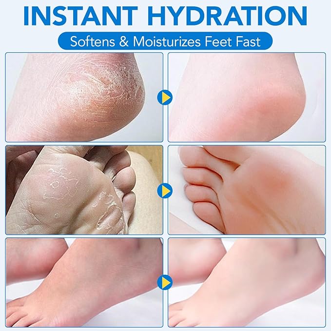 Uruses 2Pack Urea Cream 60% plus Salicylic Acid 2% Urea Foot Care Stick - Image 6