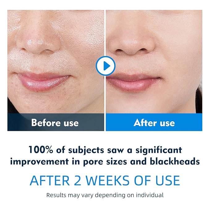 IREV Facial Toner Pads for Exfoliation and Pore Care - Image 2