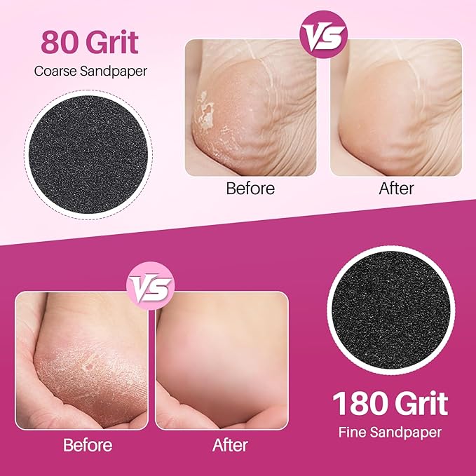 Replaceable Sandpaper for Electric Foot File: 60 Pcs/1 Box Feet Grinder for - Image 4