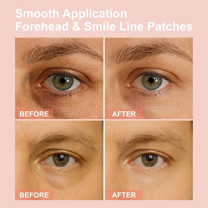 Micro Eye Patches, Under Eye Patches - Image 4