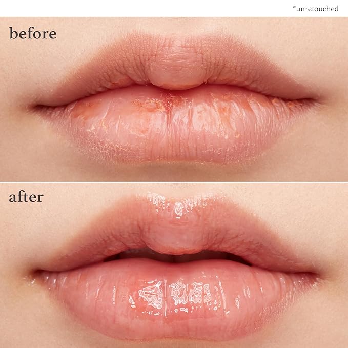 NOONI Vegan Applebutter Lip Mask Overnight – Hydrating Lip Balm & Butter - Image 3