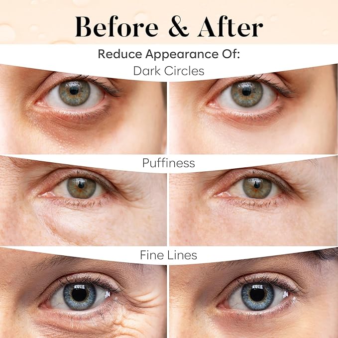 BLOOMORA Caffeine Under Eye Patches, Under Eye Mask - Image 4