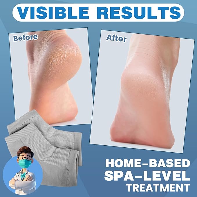 TEAWOO 6 Pairs Moisturizing Heel Socks - Image 2