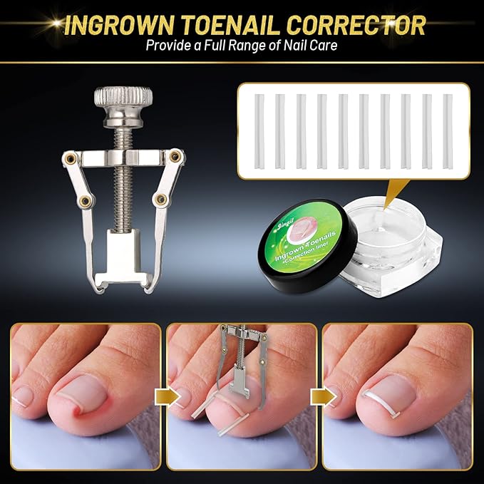 10 PCS Toenail Clippers Tool Kit, Modacraft Professional Podiatrist Nail - Image 5