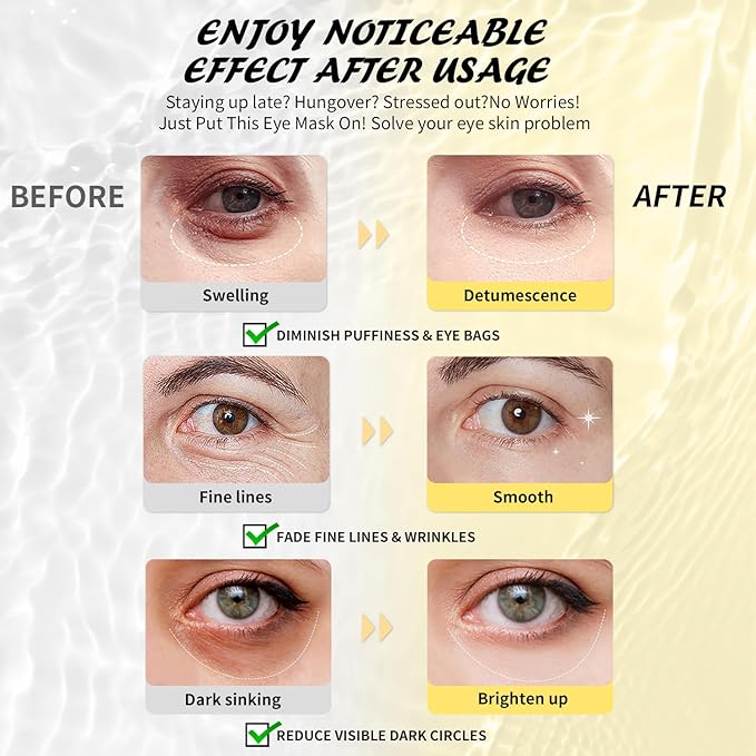 Maskiss Under Eye Patches, Caffeine Eye Masks - Image 3
